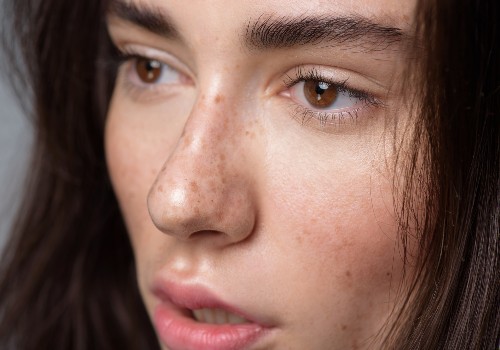 Close-up of a woman's eyes and cheeks showing freckles and natural skin texture