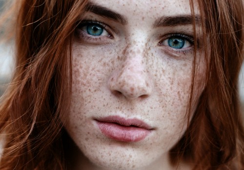 Close-up of a red-haired woman's face showing freckles across her nose and cheeks
