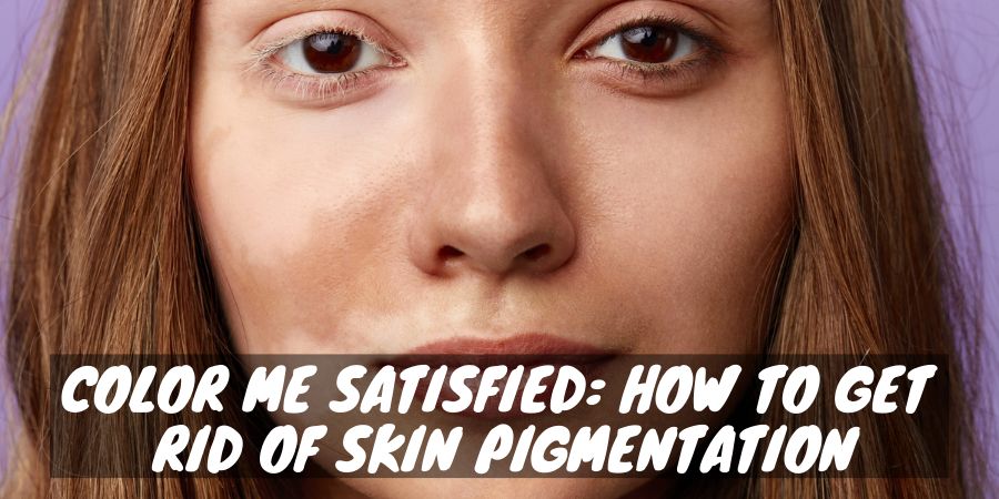 A woman with a skin pigmentation