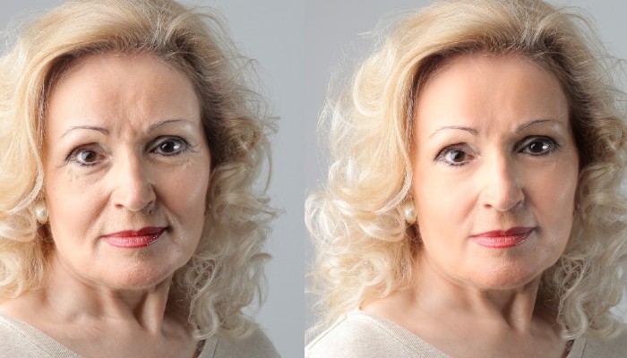 Side-by-side portraits of the same woman, with facial lines appearing softer in the right-hand image