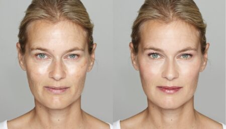 Revitalize Your Skin: Microdermabrasion | Skin Novus