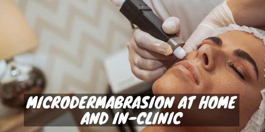 Benefits from microdermabrasion