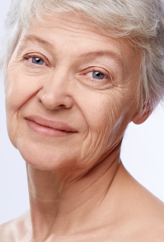 Woman with deep forehead wrinkles